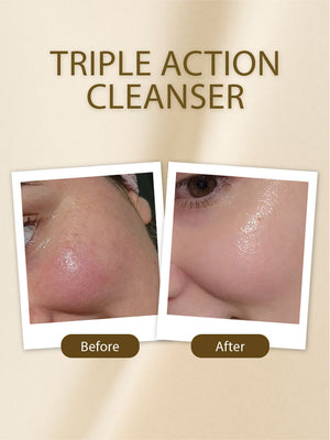 Triple Action Cleanser - Golden Girl Cosmetics