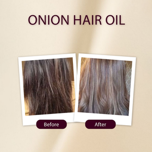 Onion Hair Oil - Golden Girl Cosmetics