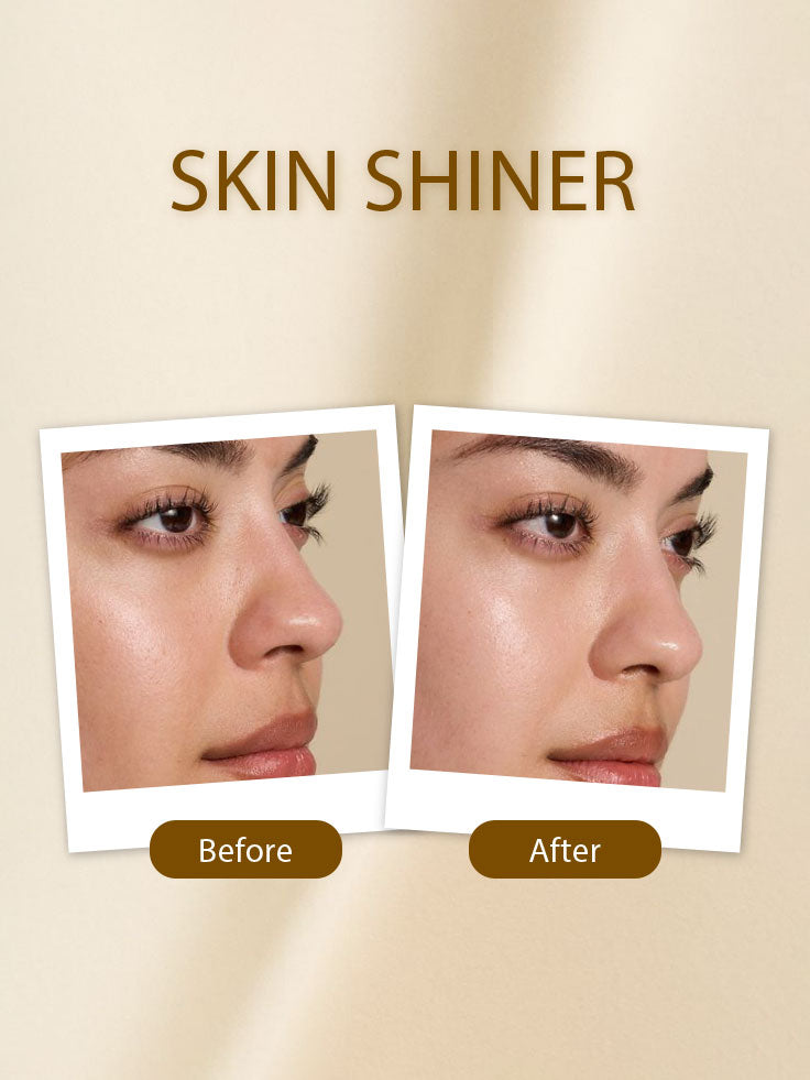 Before and after comparison of a person's face with 'Skin Shiner' text on a beige background.