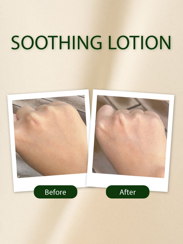 Before and after showing the effect of soothing lotion on skin.